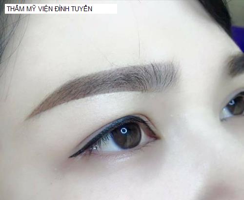 Bảng giá THẨM MỸ VIỆN ĐÌNH TUYỂN