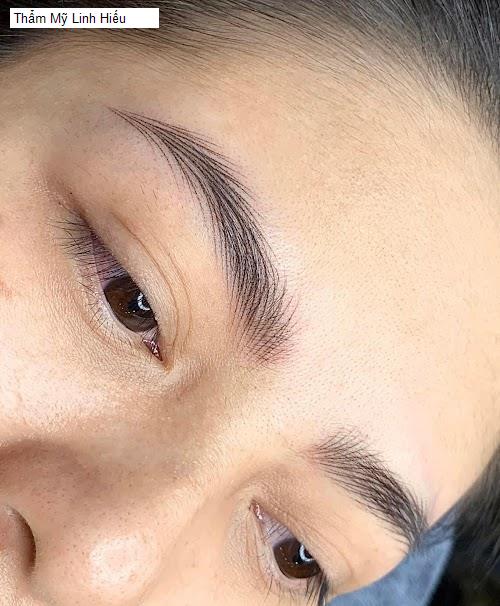 Hình ảnh Thẩm Mỹ Linh Hiếu