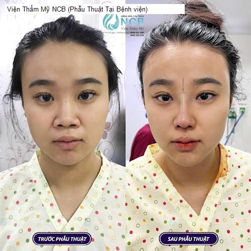 Bảng giá Viện Thẩm Mỹ NCB (Phẫu Thuật Tại Bệnh viện)