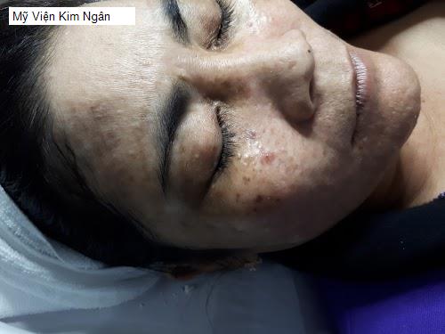 Bảng giá Mỹ Viện Kim Ngân