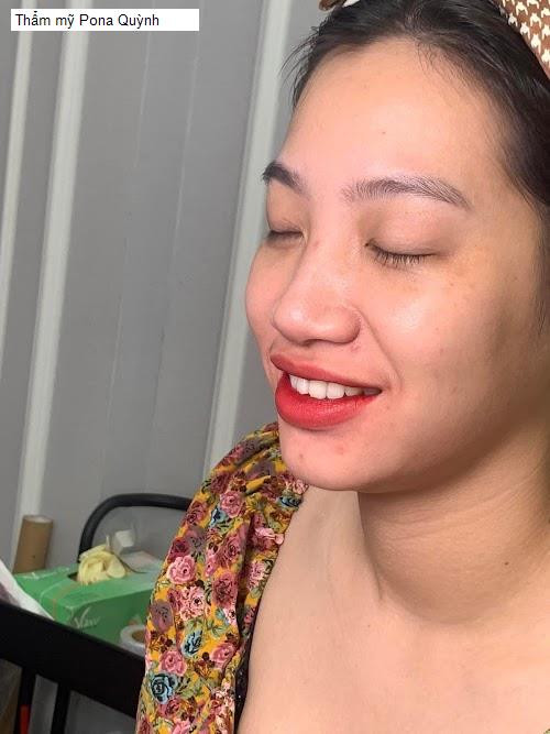 Hình ảnh Thẩm mỹ Pona Quỳnh