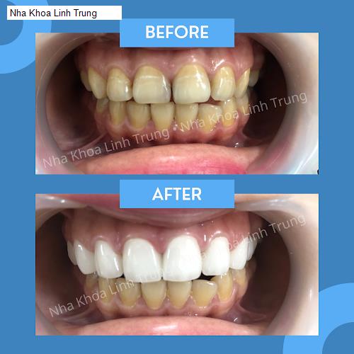 Hình ảnh Nha Khoa Linh Trung