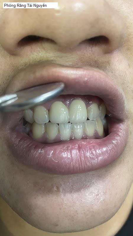 Hình ảnh Phòng Răng Tài Nguyên