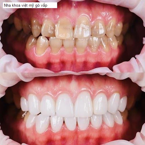 Hình ảnh Nha khoa việt mỹ gò vấp