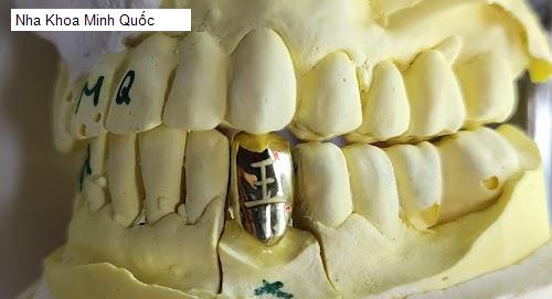Hình ảnh Nha Khoa Minh Quốc