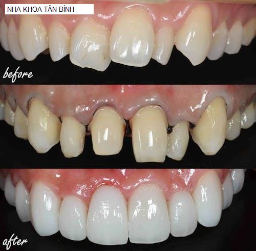 Hình ảnh NHA KHOA TÂN BÌNH