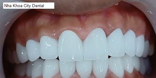 Hình ảnh Nha Khoa City Dental