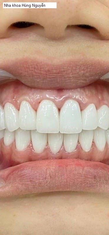 Hình ảnh Nha khoa Hùng Nguyễn