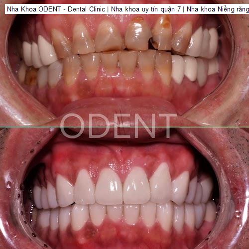 Hình ảnh Nha Khoa ODENT - Dental Clinic | Nha khoa uy tín quận 7 | Nha khoa Niềng răng, Veneer và Cấy ghép Implant