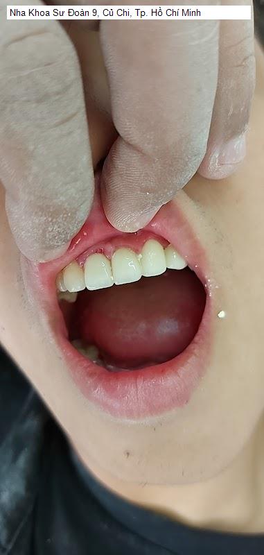 Hình ảnh Nha Khoa Sư Đoàn 9, Củ Chi, Tp. Hồ Chí Minh