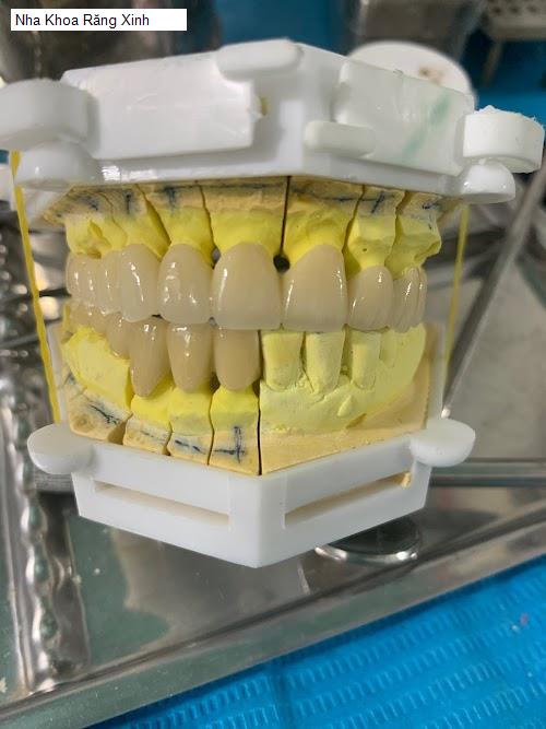 Hình ảnh Nha Khoa Răng Xinh