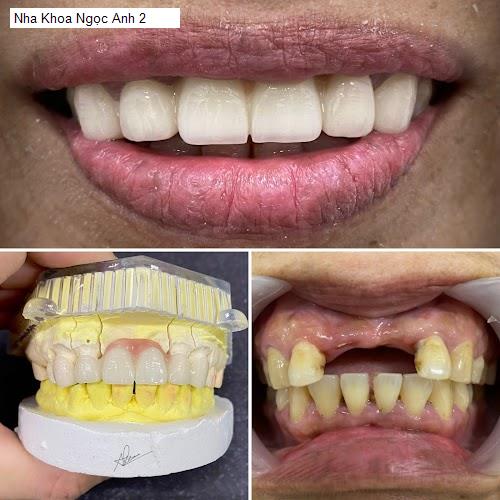 Hình ảnh Nha Khoa Ngọc Anh 2