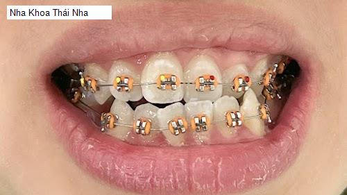 Hình ảnh Nha Khoa Thái Nha