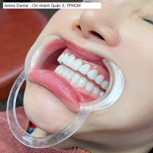 Hình ảnh Airline Dental - Chi nhánh Quận 5, TPHCM