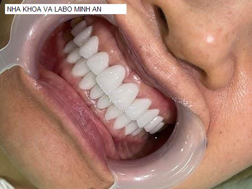 Hình ảnh NHA KHOA VA LABO MINH AN