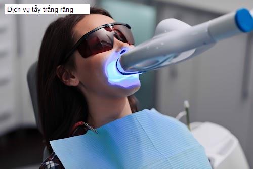 Hình ảnh Dịch vụ tẩy trắng răng