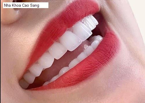 Hình ảnh Nha Khoa Cao Sang