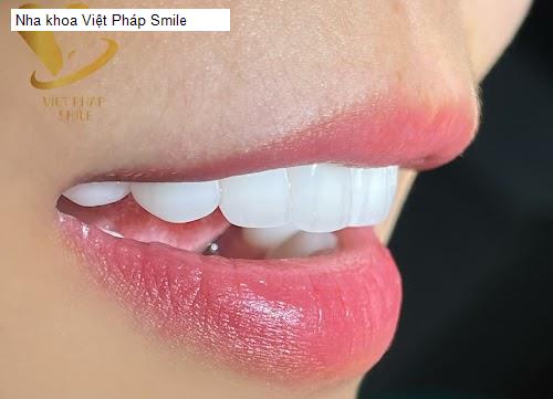 Hình ảnh Nha khoa Việt Pháp Smile