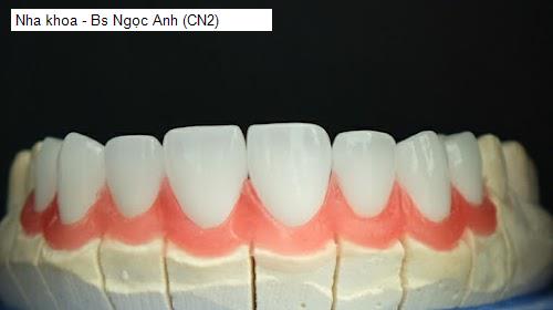 Hình ảnh Nha khoa - Bs Ngọc Anh (CN2)